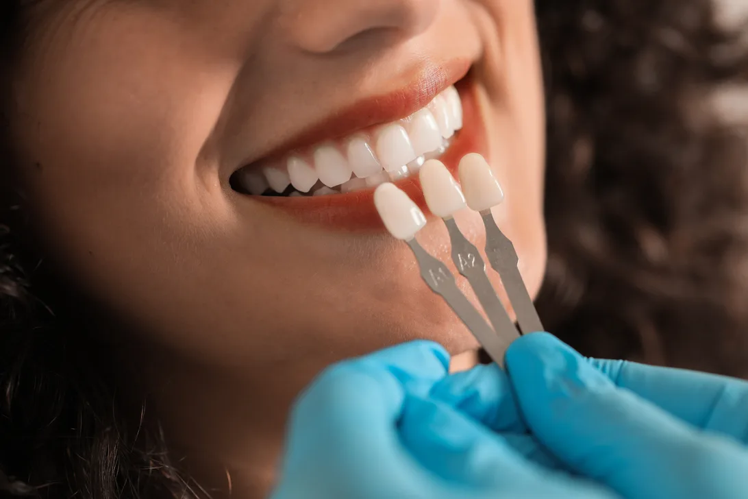 Cosmetic Dentistry